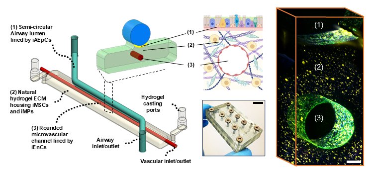Autologous Airway-on-chip for Down syndrome immune dysfunction modelling